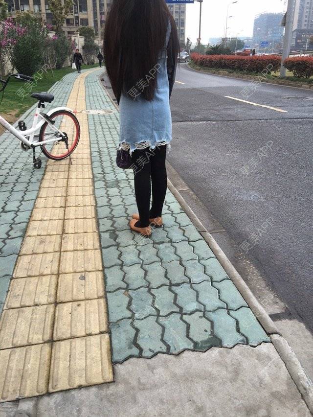 更美 - 慢漫曼小姐的吸脂瘦大腿经验 | 宁波 | 吸脂瘦大腿