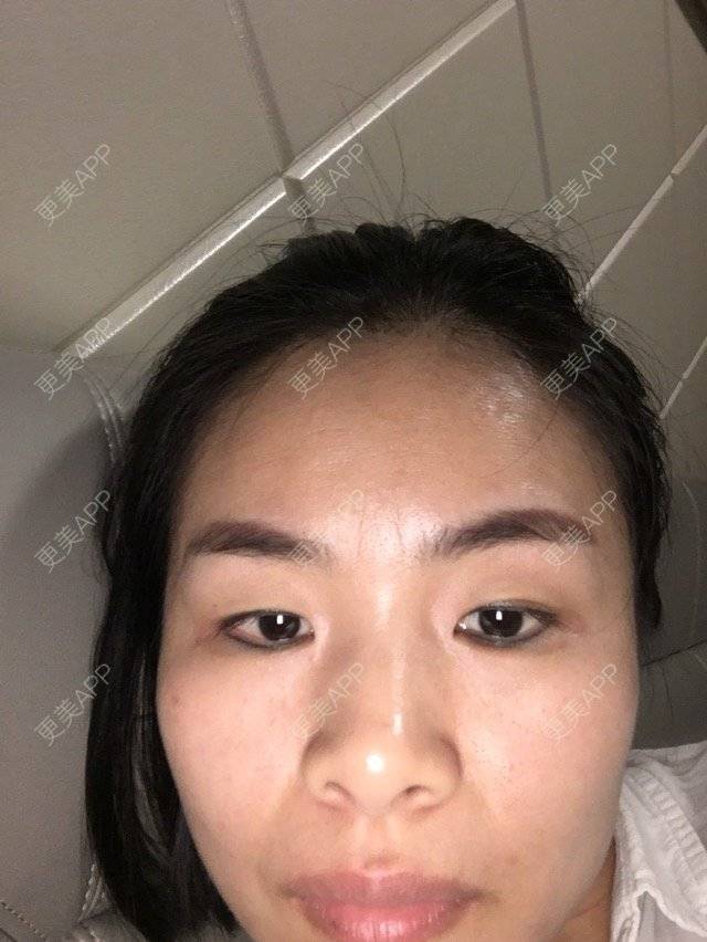 更美 - 更美用户sfBC0blfxt的经验 | 洗眼线 | 深圳