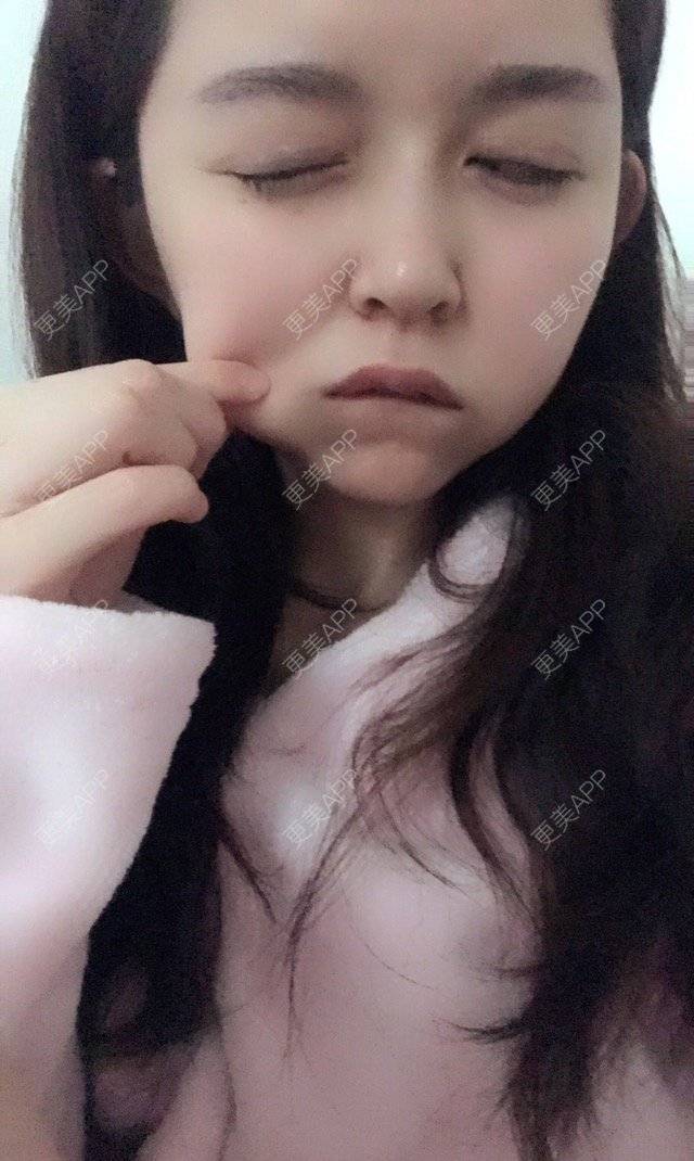 更美 - Honey-🌼的经验 | 我要免费全身抽脂 | 全身抽脂 | 免费面部吸脂 | 深圳