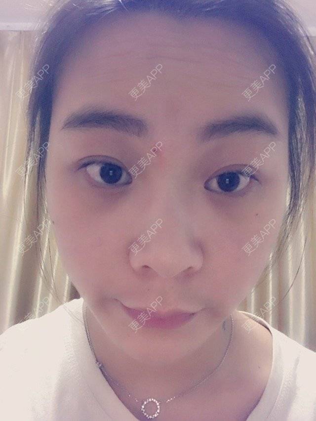 更美 - 生如.夏花的经验 | 抬头纹
