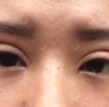 黑天鹅_