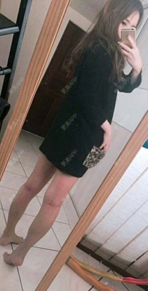 更美用户ki644blkd3的瘦腿日记