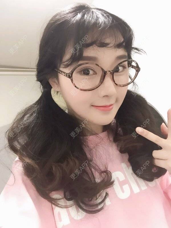 更美 - 慧慧1的眼睑下至经验 | 韩国绮林整形外科 | 鼻部修复 | 眼睑下至 | 首尔
