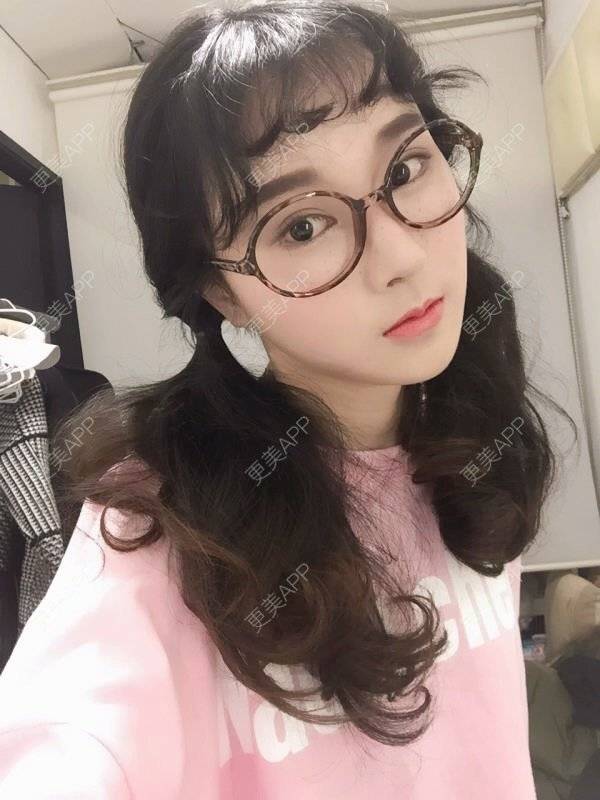 更美 - 慧慧1的眼睑下至经验 | 韩国绮林整形外科 | 鼻部修复 | 眼睑下至 | 首尔