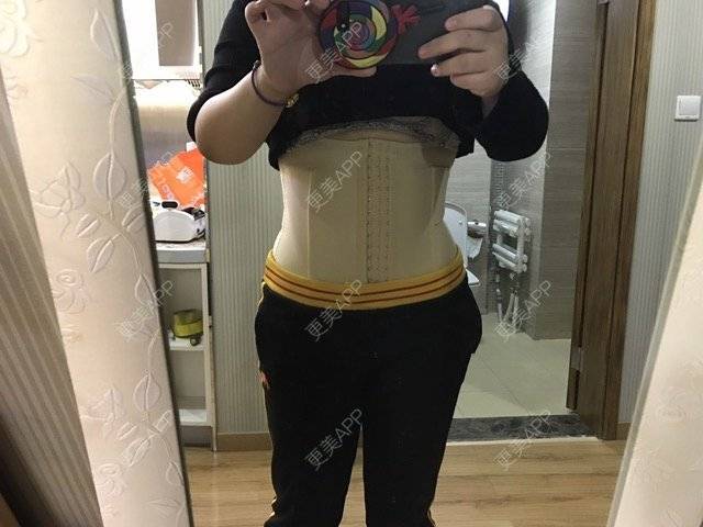 110斤目标的吸脂日记