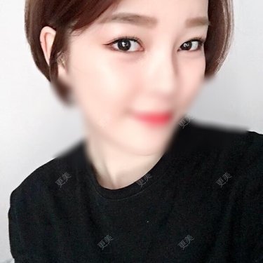 miyoa