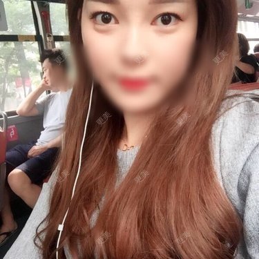 miyoa