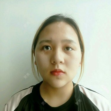 自体脂肪全面部填充