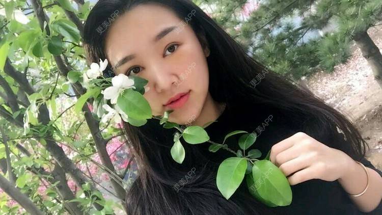 更美 - 北京蕾士悦容医疗美容的全切双眼皮经验 | 全切双眼皮