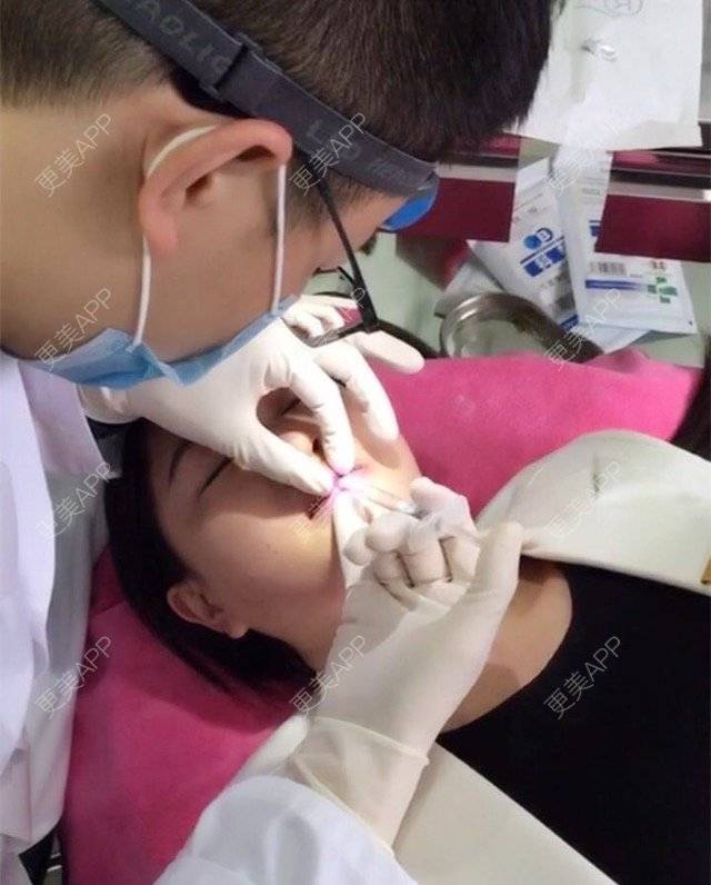 更美 - 宾仁 医生的玻尿酸经验 | 玻尿酸 | 湘潭