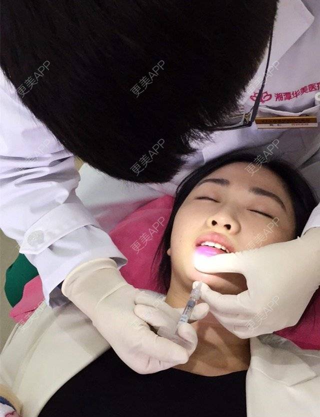 更美 - 宾仁 医生的玻尿酸经验 | 玻尿酸 | 湘潭
