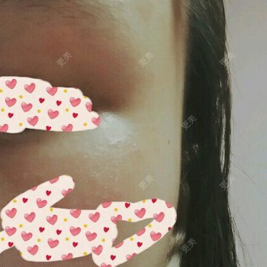hhhi