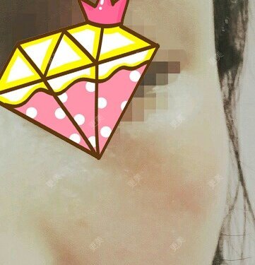 hhhi