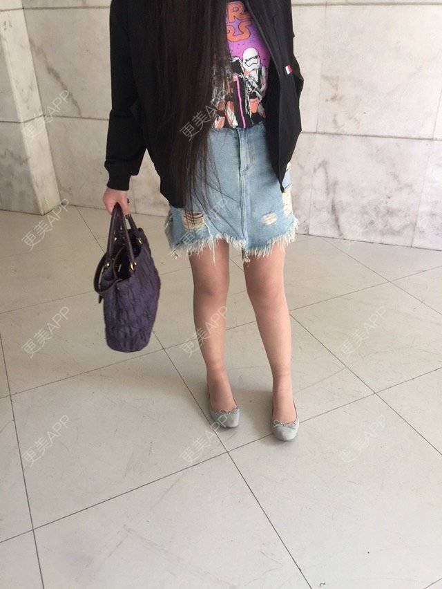 更美 - 慢漫曼小姐的吸脂瘦大腿经验 | 宁波 | 吸脂瘦大腿