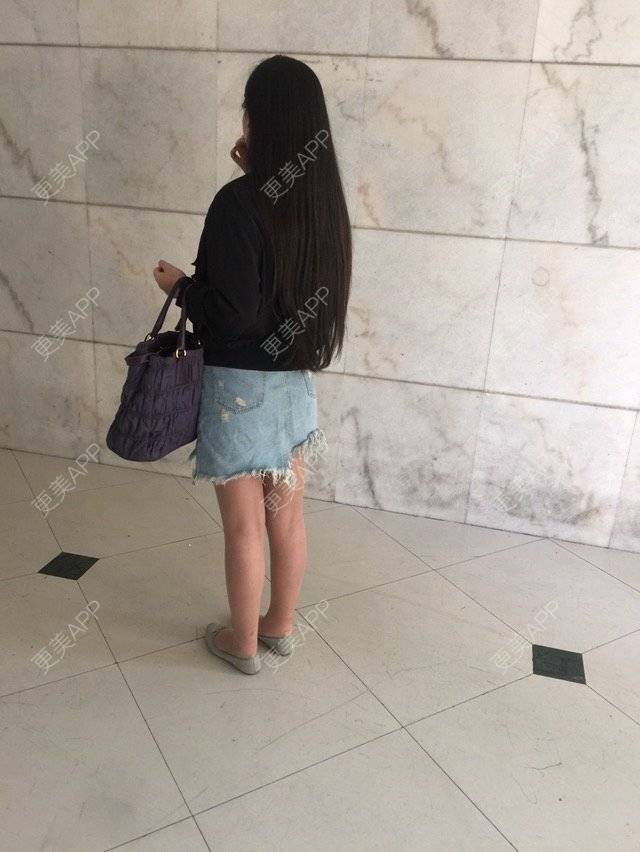 更美 - 慢漫曼小姐的吸脂瘦大腿经验 | 宁波 | 吸脂瘦大腿