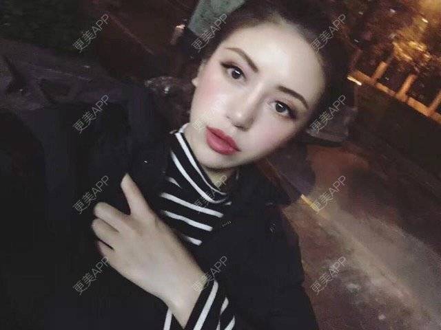 更美 - Cherry˘⌣˘ღ的隐形牙齿矫正经验 | 隐形牙齿矫正 | 广州
