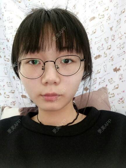 更美 - 更美用户eYsqFsnVkf的经验 | 近视矫正 | 南京