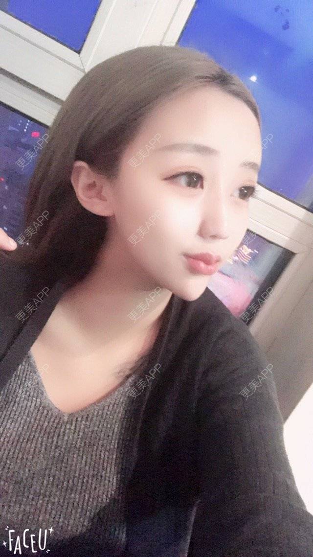 更美 - 张Star的经验 | 嘟嘟唇 | 哈尔滨