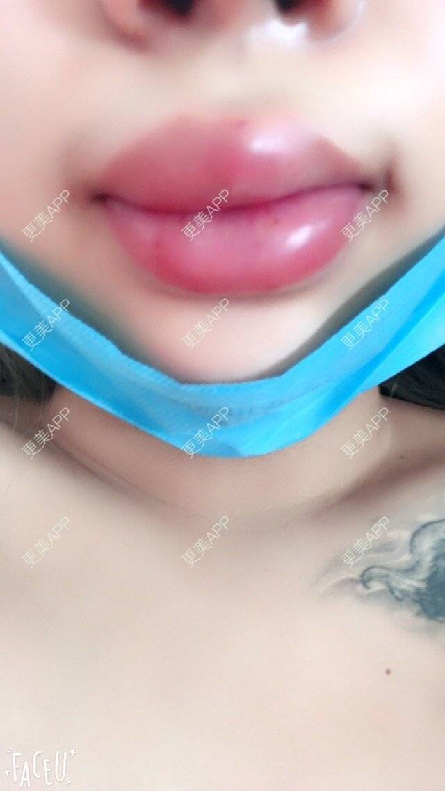 更美 - 张Star的经验 | 嘟嘟唇 | 哈尔滨