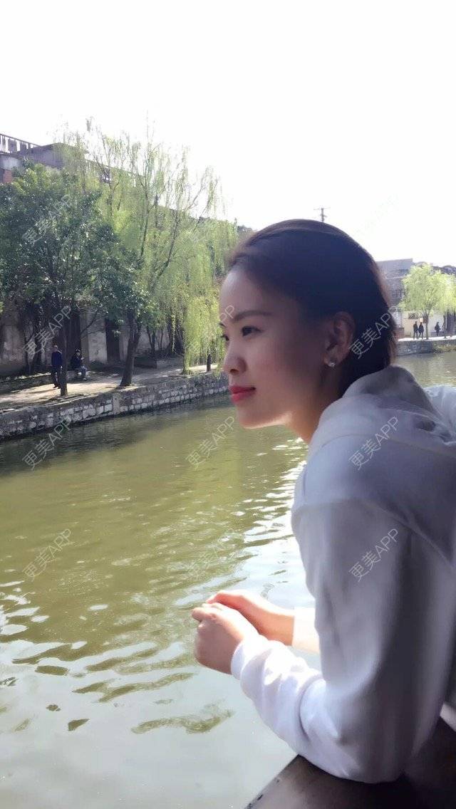 更美 - 更美用户7781927869的经验 | 鼻部整形 | 双眼皮埋线