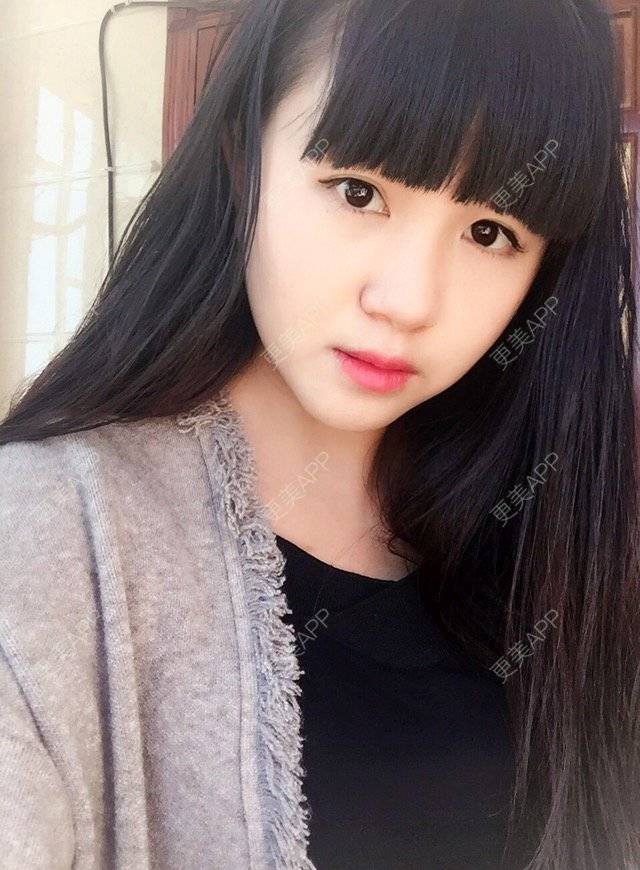 更美 - 晴儿更美的经验 | 想做鼻子