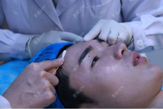 更美 - 笑笑笑水阁的玻尿酸额头经验 | 玻尿酸额头 | 长沙