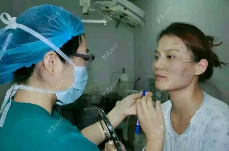 更美 - 黄丽华 医生的自体脂肪全面部填充经验 | 自体脂肪全面部填充 | 深圳