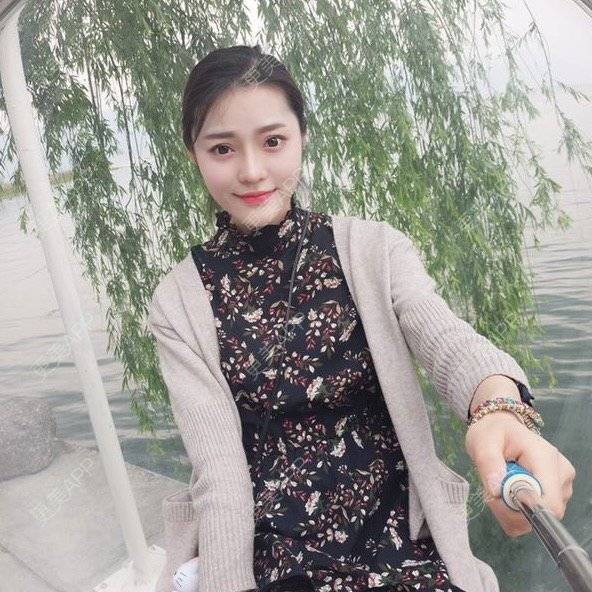更美 - 玥玥子子的经验 | 隆鼻假体 | 西安