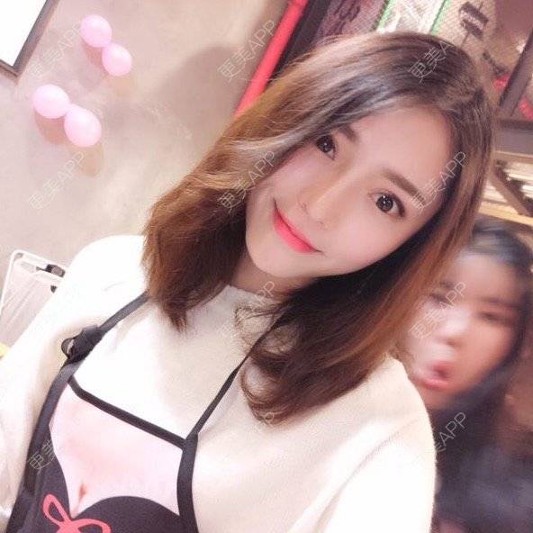 更美 - 玥玥子子的经验 | 隆鼻假体 | 西安