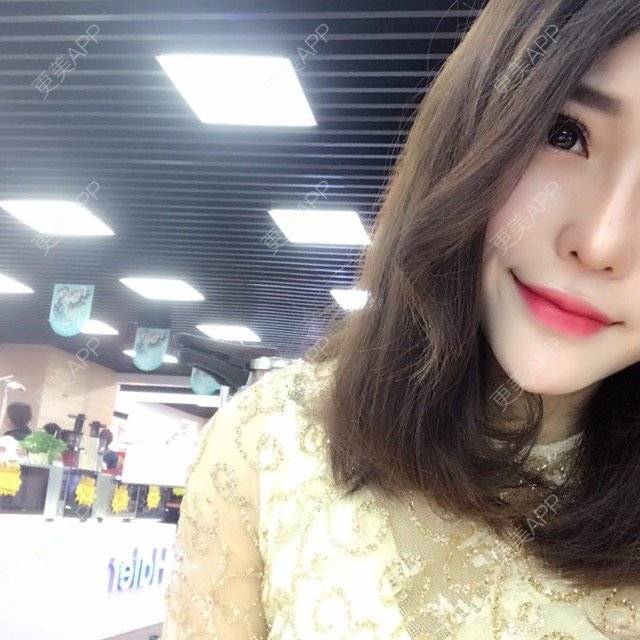 更美 - 玥玥子子的经验 | 隆鼻假体 | 西安