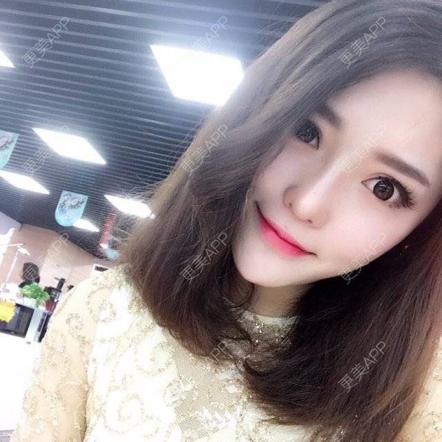 更美 - 玥玥子子的经验 | 隆鼻假体 | 西安