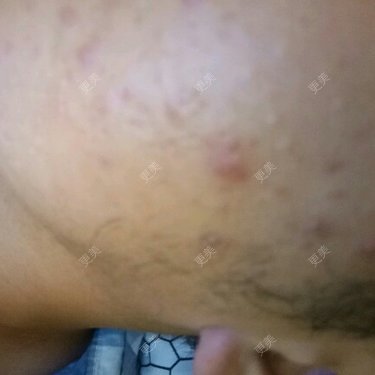 更美用户Sk9BwVG8BU