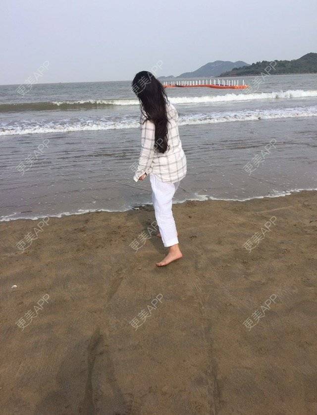 更美 - 慢漫曼小姐的吸脂瘦大腿经验 | 宁波 | 吸脂瘦大腿