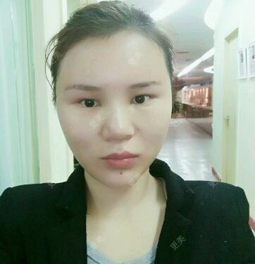 黄丽华 医生