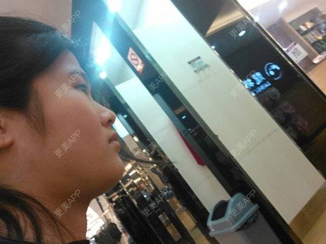 更美 - 贤惠的小仙女🧚‍♀️的经验 | 眼部多项 | 全面部脂肪填充 | 上海