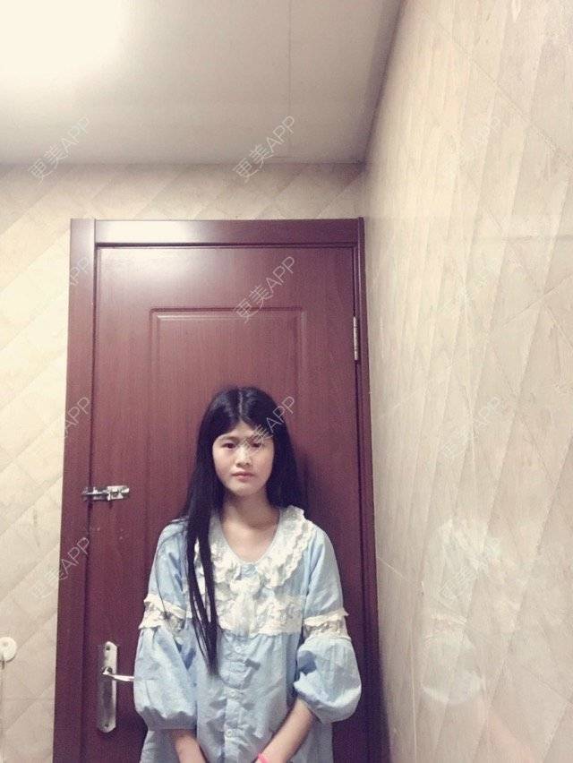 更美 - 贤惠的小仙女🧚‍♀️的经验 | 眼部多项 | 全面部脂肪填充 | 上海