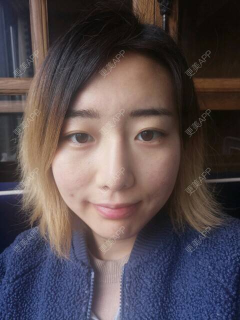 更美 - Cold婷的经验 | 皮肤美容 | 脸部痘痘 | 长沙