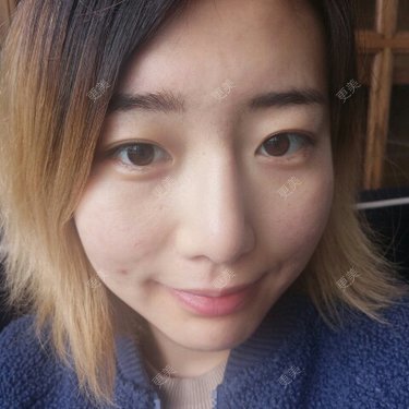 Cold婷