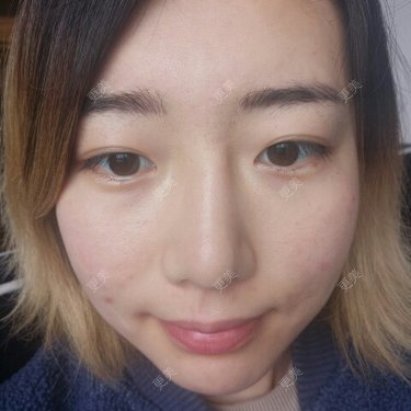 Cold婷