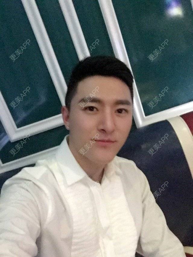 更美 - 柳安花明又一村的玻尿酸额头经验 | 长沙 | 玻尿酸额头