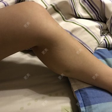 怕疼的丢丢