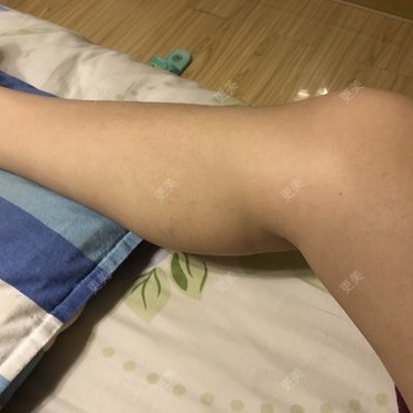 怕疼的丢丢