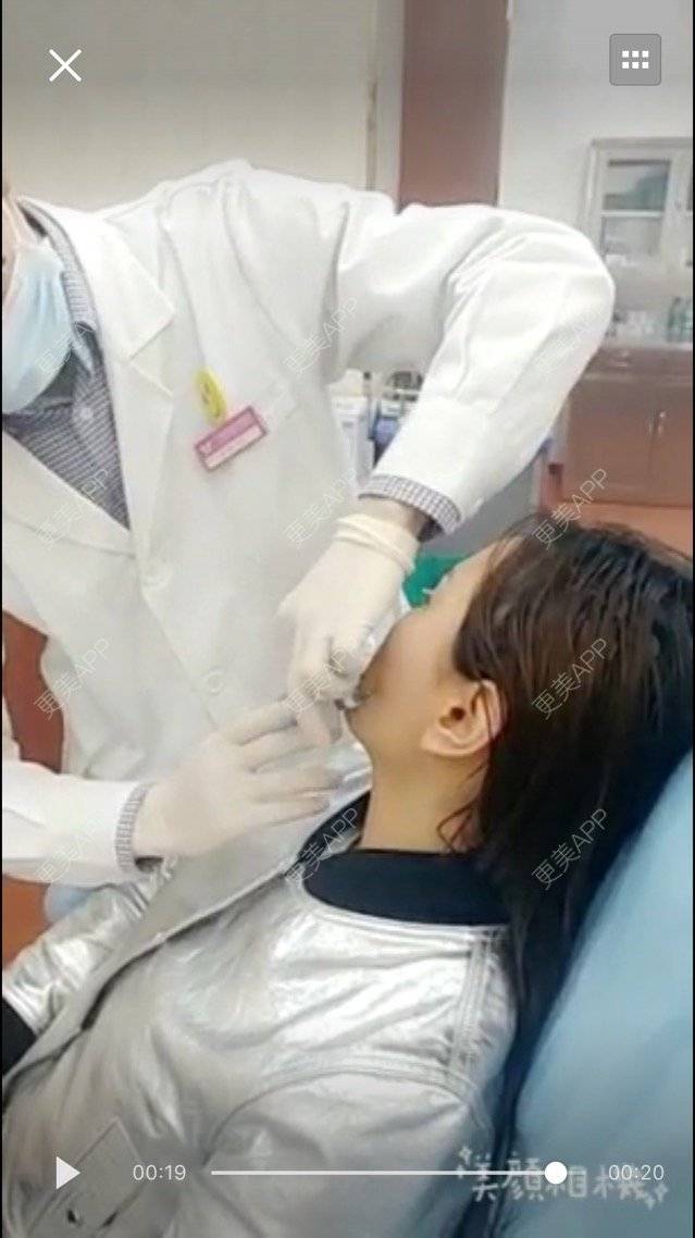 更美 - 小丽哒💋的经验 | 艾莉薇 | 玻尿酸填面颊凹坑 | 面部轮廓 | 大庆