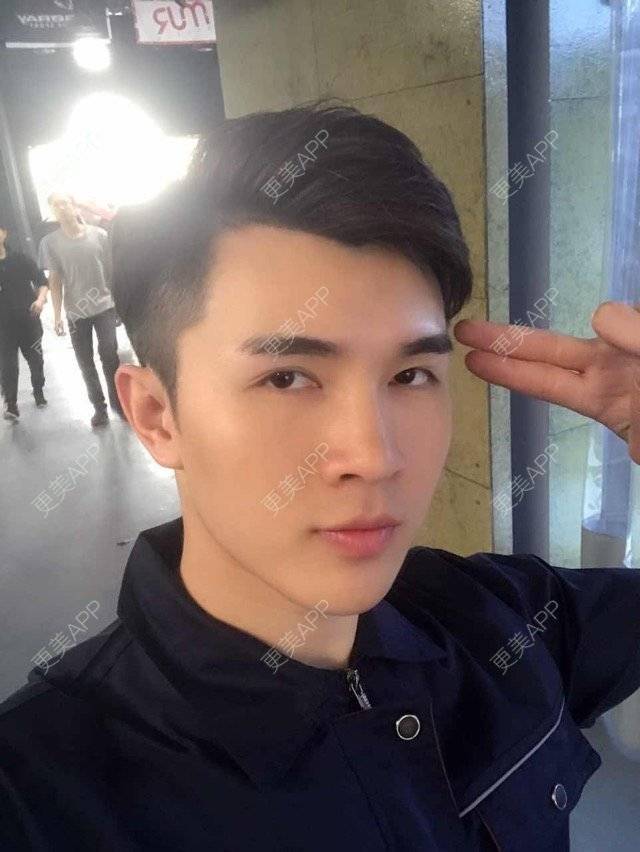 更美 - 笑笑笑水阁的玻尿酸额头经验 | 玻尿酸额头 | 长沙