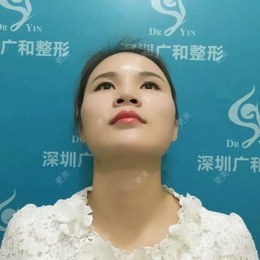 黄丽华 医生