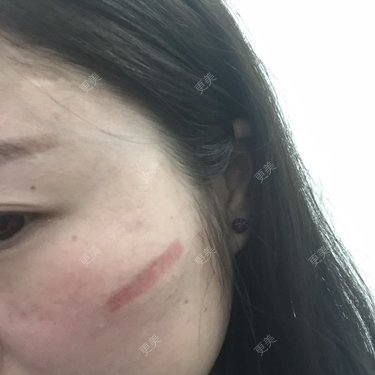 小幸运小幸运小幸运