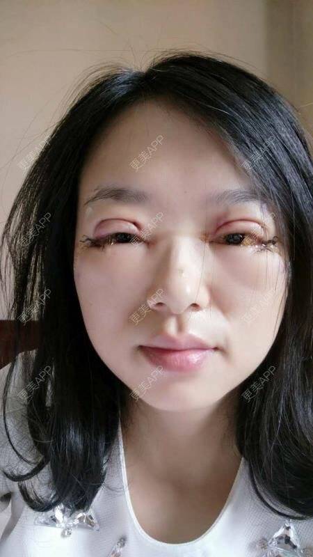 晶晶的的开外眼角日记