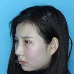 李家彪 医生