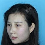 李家彪 医生