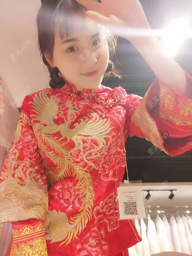 雨梦迟歌的自体脂肪填充面部